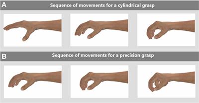 SOPHIA: Soft Orthotic Physiotherapy Hand Interactive Aid